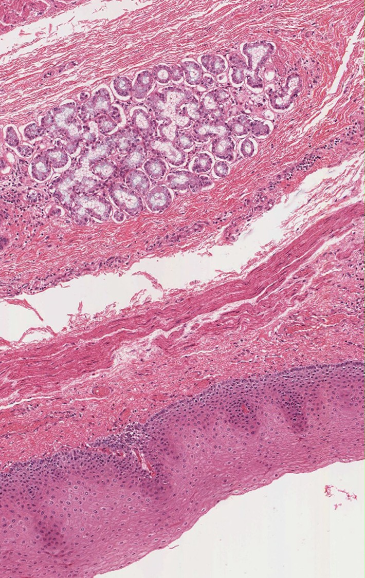 Esophagus Stomach Junction Histology Labeled